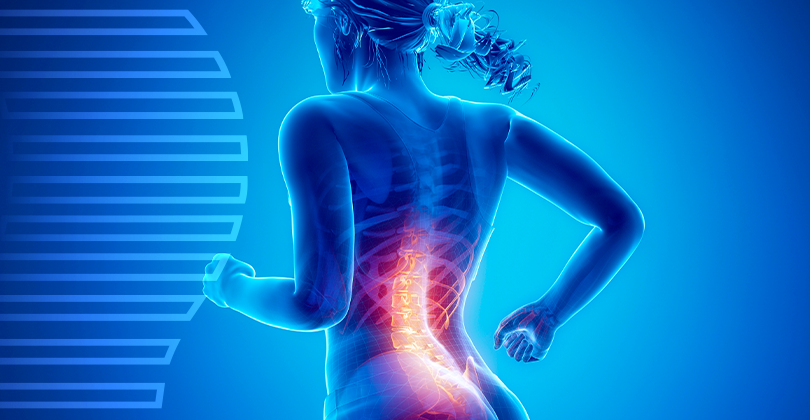 Imagem Cirurgia de Hérnia de Disco