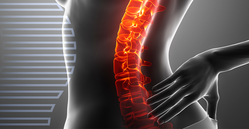 Imagem Cirurgia de Hérnia de Disco
