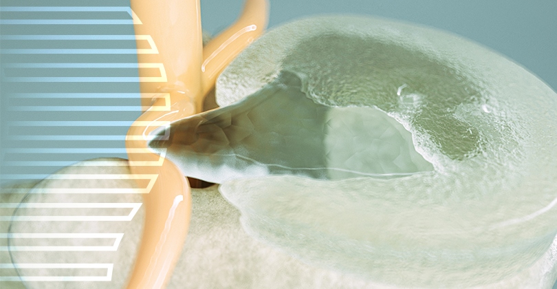 Imagem Cirurgia de Hérnia de Disco
