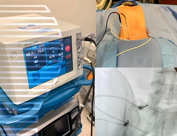 Imagem Cirurgia de Hérnia de Disco